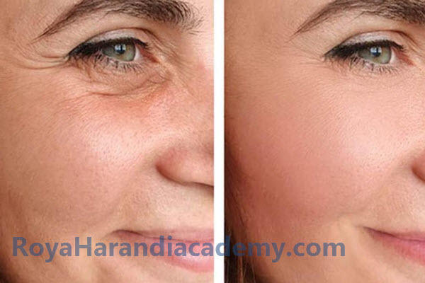 بهترین آموزش دوره تخصصی جوانسازی و فشیال صورت