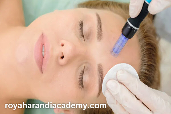 روش درمانی میکرونیدلینگ چکونه انجام می شود؟ | آکادمی رویا هرندی