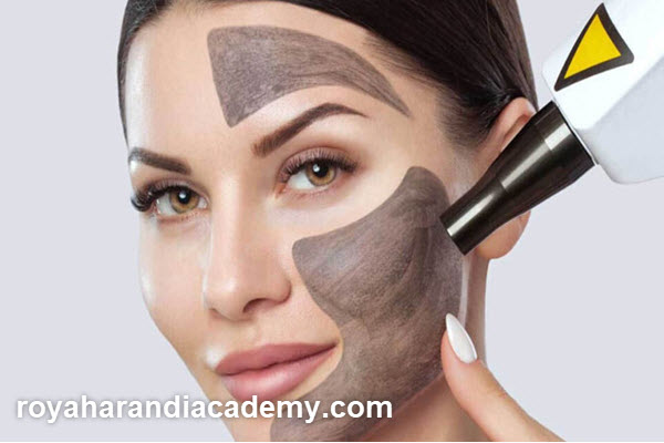 قیمت کربن تراپی با لیزر در غرب تهران | آکادمی رویا هرندی