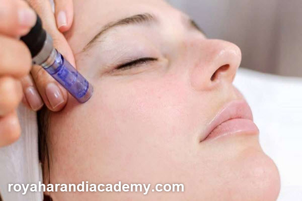 هزینه میکرونیدلینگ صورت چقدر است؟