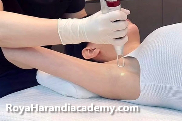 کربن تراپی زیر بغل چیست؟