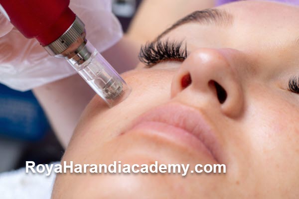 میکرونیدلینگ صورت چیست؟
