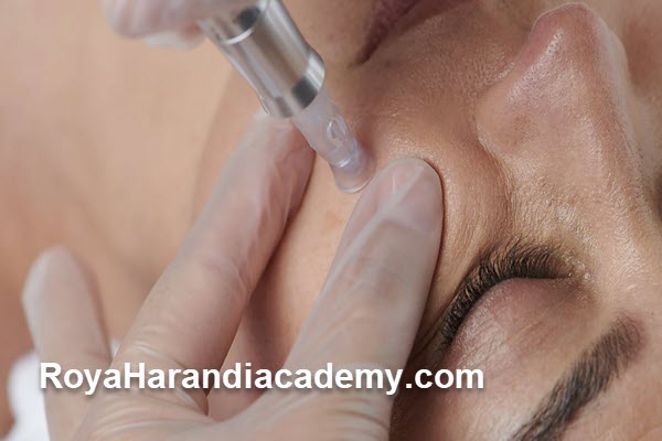 بهترین مرکز میکرونیدلینگ صورت در غرب تهران