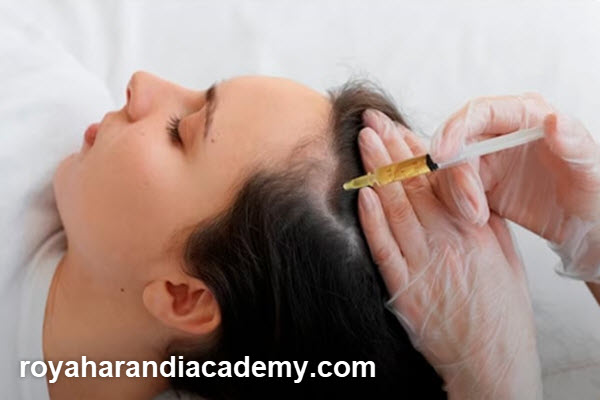 عوامل موثر بر ماندگاری مزوتراپی مو