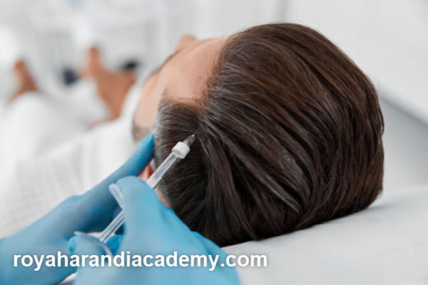 ماندگاری مزوتراپی مو