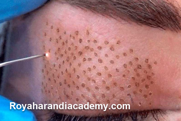 پلاسما جت چیست و چه کاربردهایی دارد؟